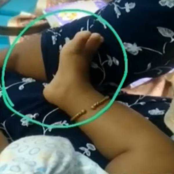 Why did shivering in legs and hands for new born baby in Kovilpatti? Why did shivering in legs and hands for new born baby in Kovilpatti?