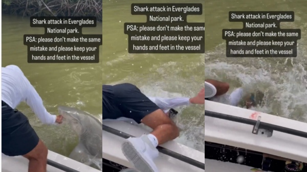  Netizens shocked to see Shark Bites Mans Hand And Dragging Him Into The Water
