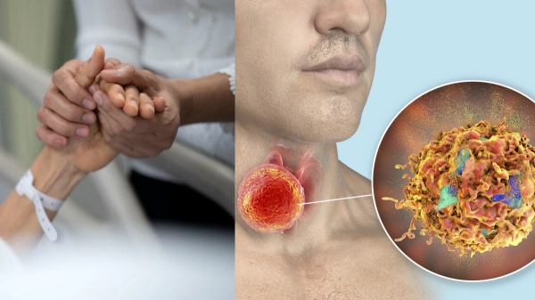  How lifestyle changes are raising Head and neck cancers rising in India