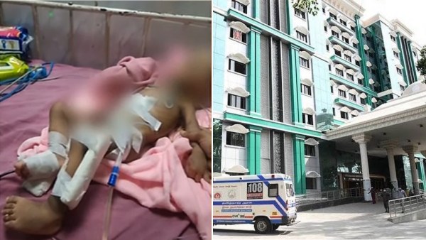 How did one and a half year old childs hand get affected? Rajiv Gandhi Hospital Give Explanation 