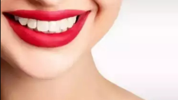 Best Health tips and do you know what are the Excellent home remedies to cure Tooth Sensitivity