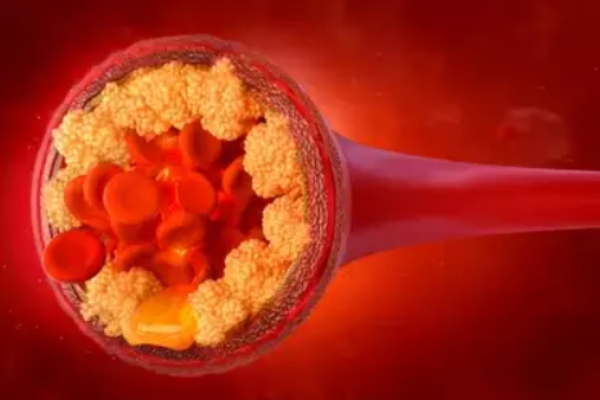 Health benefits of Pear and amazing medicinal properties of Pear which is helpful in weight loss Health benefits of Pear and amazing medicinal properties of Pear which is helpful in weight loss