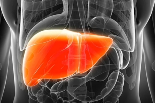 Health Fatty Liver and Do you know How to keep our liver safe and Healthy 