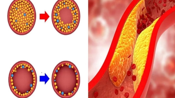 Health news and Healthy Mutton Soup, Do you know what are the benefits in the Mutton Leg Soup