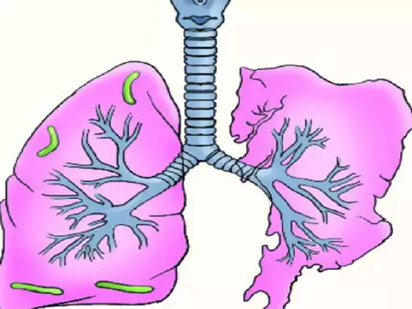 Healthy Lungs and Good Tips to clean the Lungs and Best foods to keep your lungs Healthy Healthy Lungs and Good Tips to clean the Lungs and Best foods to keep your lungs Healthy