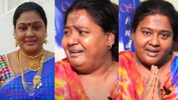 Actress Angadi Theru Sindhu suffers from cancer from another breast Actress Angadi Theru Sindhu suffers from cancer from another breast