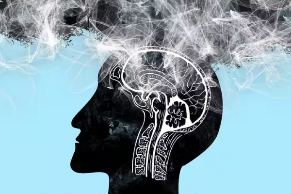  Long Covid is causing Brain Fog which is Equivalent To Ageing 10 Years