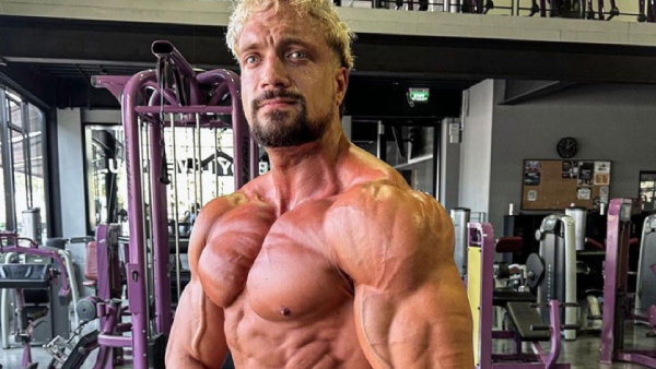  What Is Rippling Muscle Disease that killed Bodybuilding Star Jo Lindner