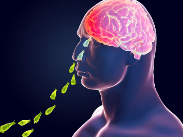 Do you know what is brain eating amoeba? How it enters into the body 