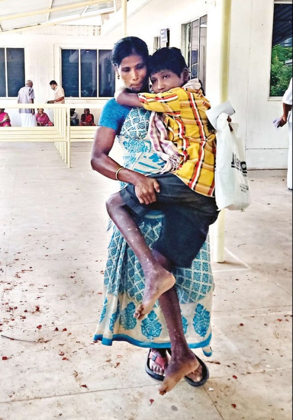 Theni Collector ordered to provide assistance including carriage to the differently abled boy 