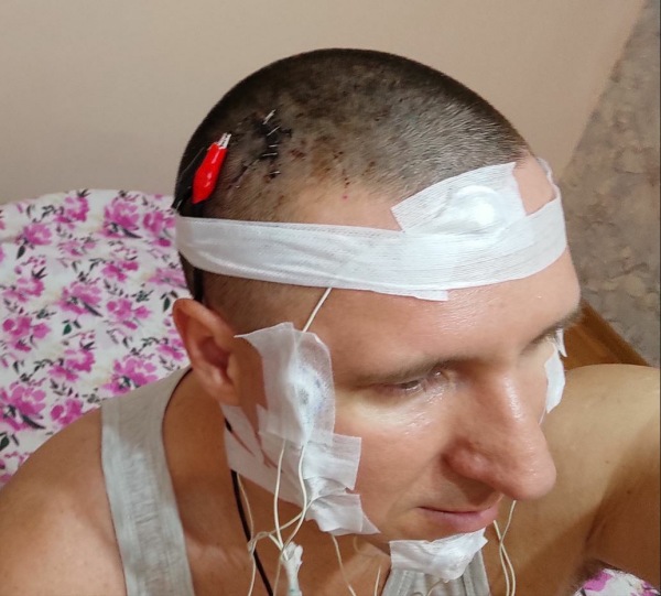 Russia man Drill and tried to place Chip Inside Brain