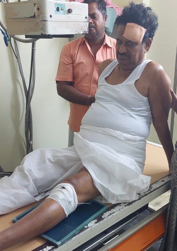 KS Azhagiri went for a walking, accidentally he tripped and fell suffered severe injuries on his forehead and knee 