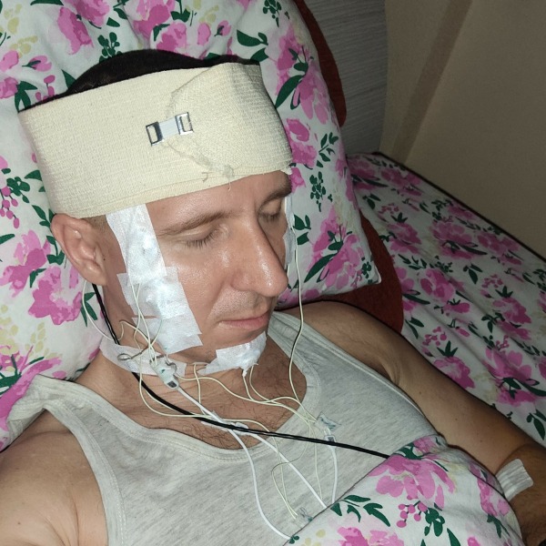 Russia man Drill and tried to place Chip Inside Brain