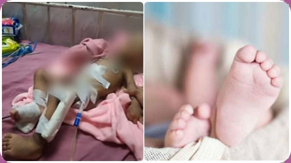 Therani Rajan explains why did Ramanathapuram baby died? 