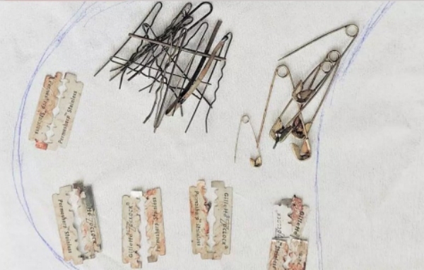 Doctors removed hair pins safety pins and blades in youths stomach 