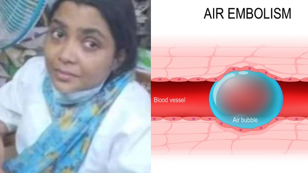 What is Air Embolism? air injected to veins 