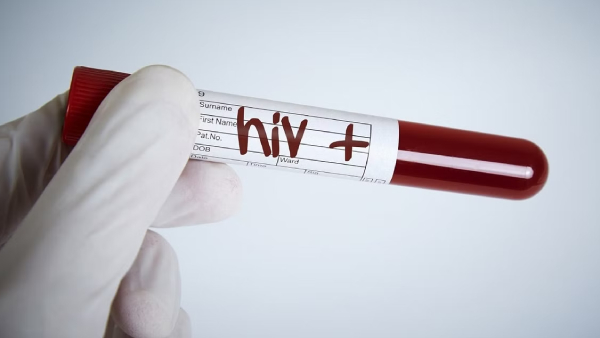 Health: More than 60 Woman testes postive for HIV AIDS in Uttar Pradesh Government hospital Health: More than 60 Woman testes postive for HIV AIDS in Uttar Pradesh Government hospital