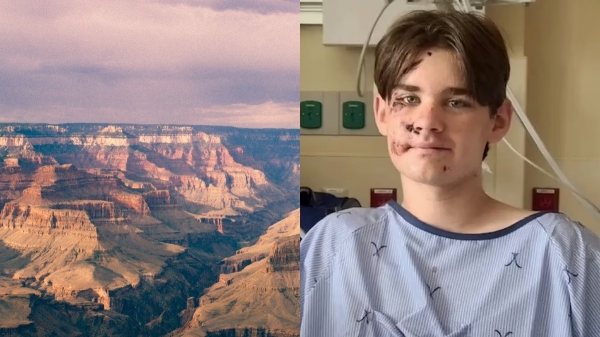  US : 13-Year-Old Boy Survives Terrifying 100-foot Fall At North Rim Grand Canyon 