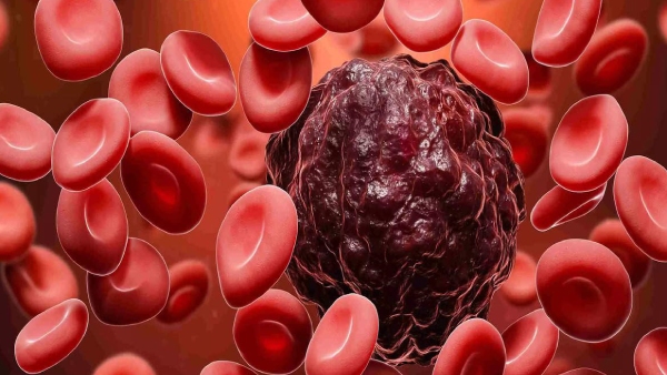 Johnson & Johnson has discovered a drug to cure blood cancer 