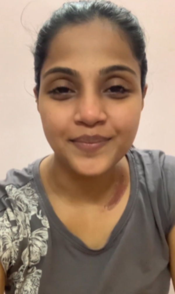 Serial actress Vaishali accident that occurred while she was traveling from Tenkasi to Tirunelveli