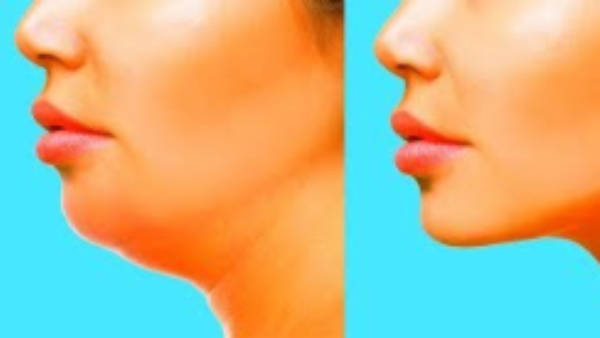 Do you know How to to get Chubby Cheeks and Health Benefits of Eating Mango Do you know How to to get Chubby Cheeks and Health Benefits of Eating Mango