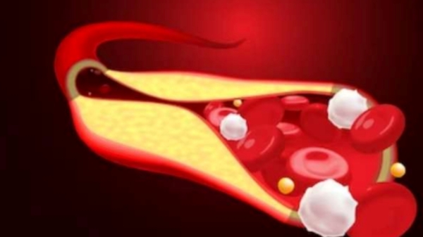 Do you know about Excellent Guava Leaf and Guava Leaf is the Best Health Tips for Weight Loss Do you know about Excellent Guava Leaf and Guava Leaf is the Best Health Tips for Weight Loss