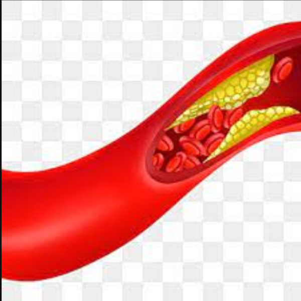 Health Excellent Benefits of Pomegranate and Do you know about Pomegranate Seeds is the Best Diet food