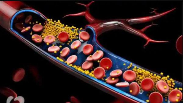 Health Benefits of Black Grape and and Black Grape Best Seeds are the Best for Heart Diseases