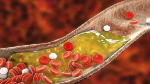 Health Benefits of Black Grape and and Black Grape Best Seeds are the Best for Heart Diseases