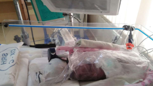 Help save twins born on the 26th month 