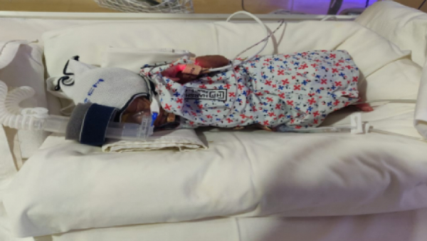 Help save twins born on the 26th month 