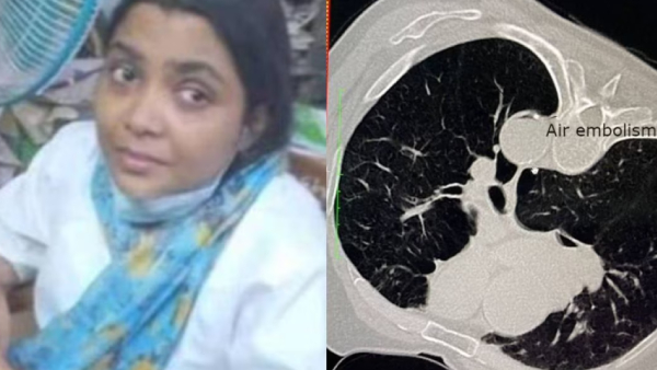 What is Air Embolism? air injected to veins 