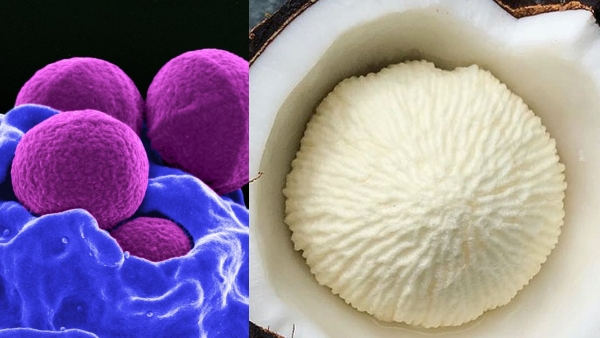 Do you know Health benefits about Coconut Flower and Coconut Flower is the Excellent Medicine for Diabetics