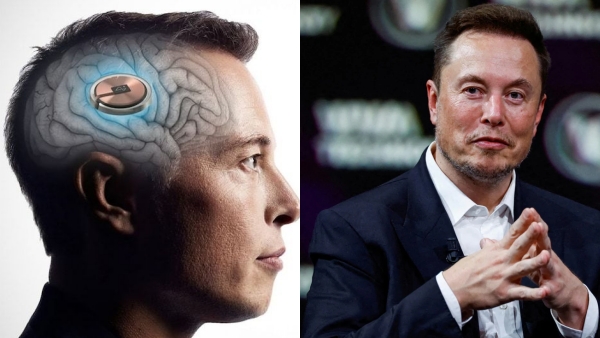  Neuralink announces human trials volunteers for its chip in brain experiment