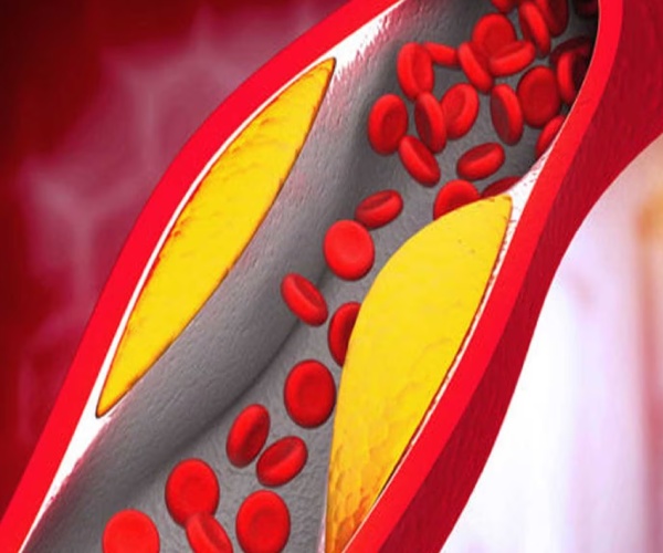 Do you know Health Benefits of Garlic and Which foods produce a lot of collagen