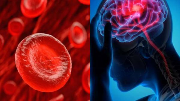 Health Benefits of Onion and Do you know eating Honey Soaked Shallots in Empty Stomach