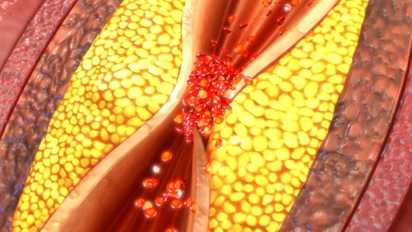 Do you know Health Benefits of Milk and Do you know Masala Milk is the Best for Lungs function Do you know Health Benefits of Milk and Do you know Masala Milk is the Best for Lungs function