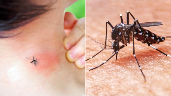 Do you know the important symptoms of Dengue fever? 