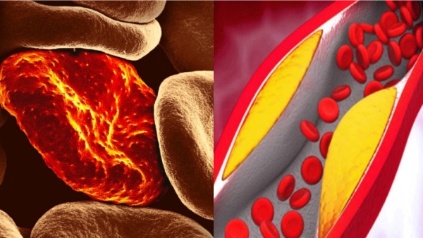 Do you know Health Benefits of Fig Fruits and Do you know Figs Fruits is the Super Food for Anemia patients