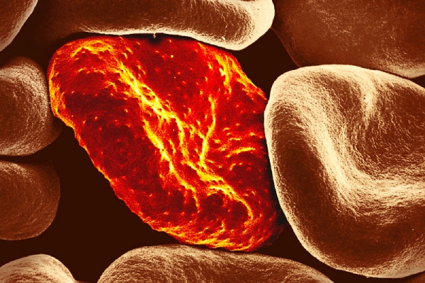 Health Super Benefits of Oats Meal and do you know what are the Excellent Healthy Breakfast 