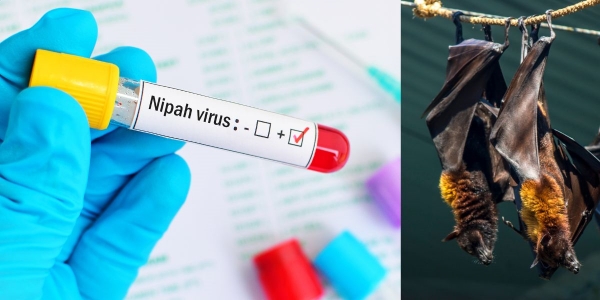 do you know how to prevent from Nipah virus? do you know how to prevent from Nipah virus?