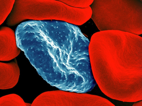 Do you know Health Benefits of Jaggery Tea and eating these 2 Soup will reduce your Body weight soon