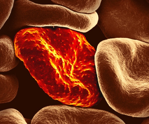 Health Medicines of Arai Keerai Seeds and Do you know how to prepare Aarai Keerai Seeds Oil Health Medicines of Arai Keerai Seeds and Do you know how to prepare Aarai Keerai Seeds Oil