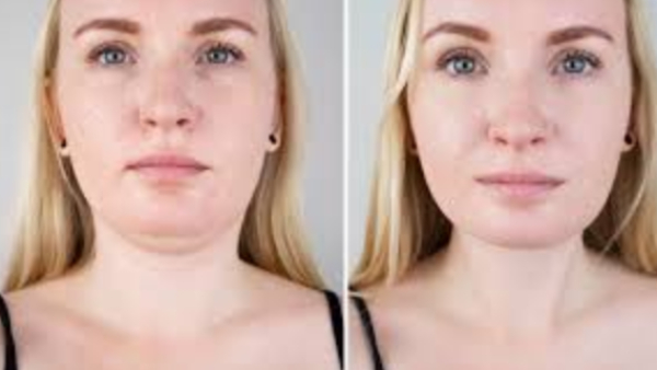 Do you know Excellent Benefits of Lemon and how to get Rid of Neck Fat easily 