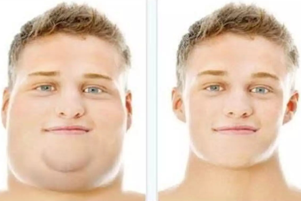 Do you know Excellent Benefits of Lemon and how to get Rid of Neck Fat easily 