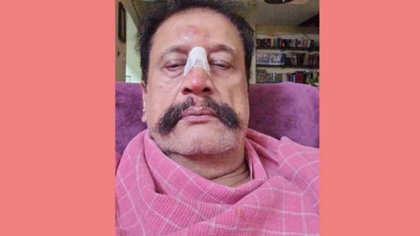 Famous Actor Mohan Sharma attacked in Chennai and complaint against mysterious gang 