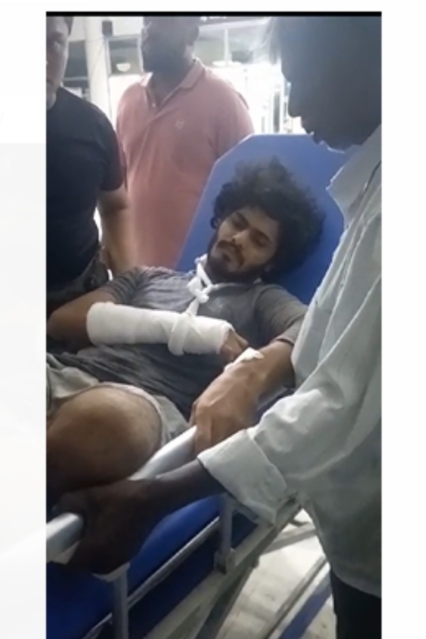 Youtuber TTF Vasan caught in major bike accident in Kancheepuram 