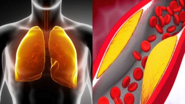 Do you know Excellent Health Benefits of Turmeric and What are the Super tips to keep Lungs Healthy Do you know Excellent Health Benefits of Turmeric and What are the Super tips to keep Lungs Healthy