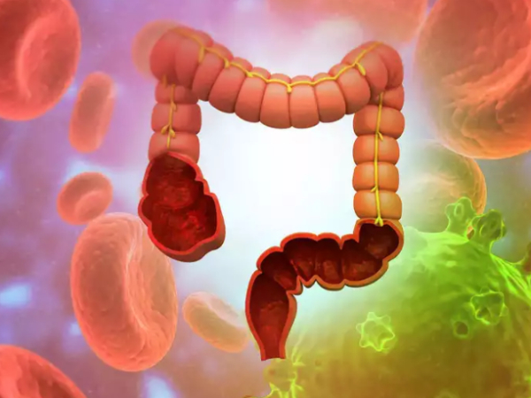 Do you know Potato is the Best for Anal itching and what are the Excellent food for control Anal Itching Do you know Potato is the Best for Anal itching and what are the Excellent food for control Anal Itching