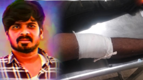 Chengalpattu police fired at Rowdy Tanika and arrest him in midnight 